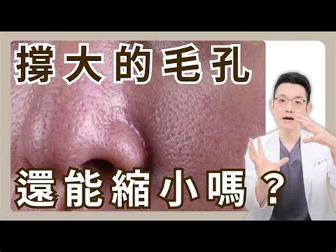 臉上有毛面相|臉長白毛位置暗示何事？